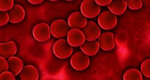 linfoma cellule sangue